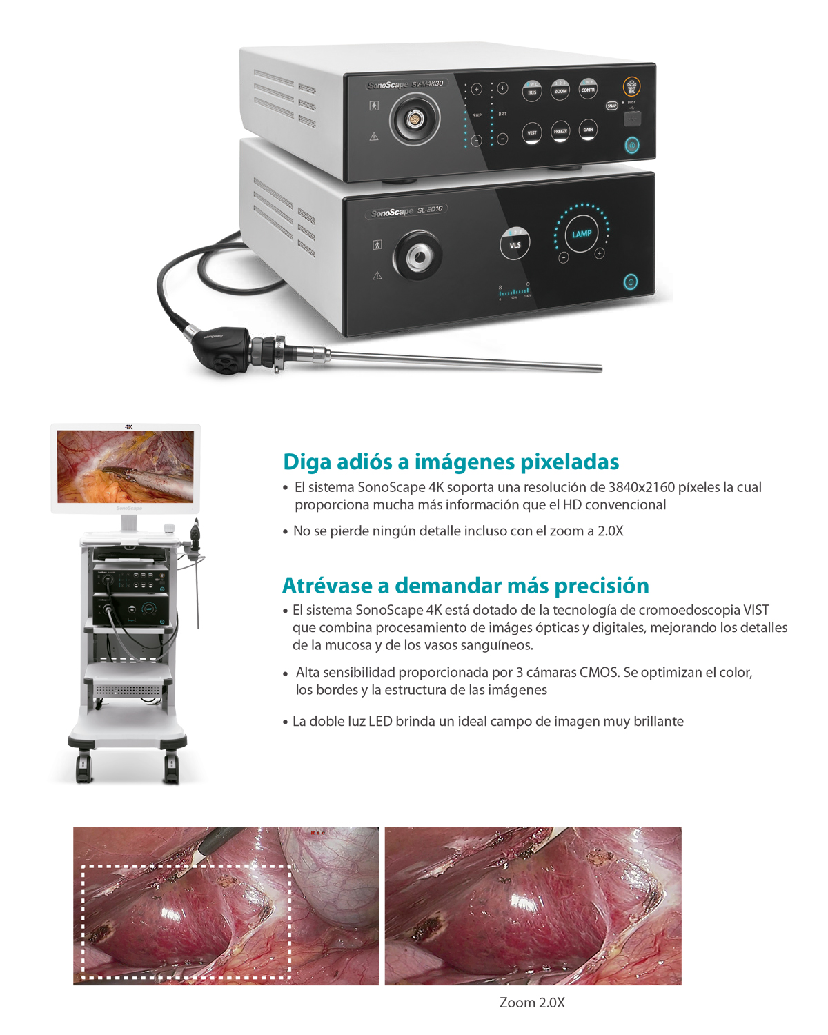 Ficha SonoScape SV-M4K30